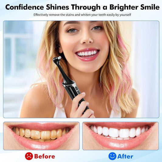 Rechargeable Electric Tooth Polisher and Denture Cleaning Kit with 6 Attachments, 5 Speed Settings, LED Light, USB-C Charging, IPX6 Waterproof Design for Convenient Daily Oral Care at Home